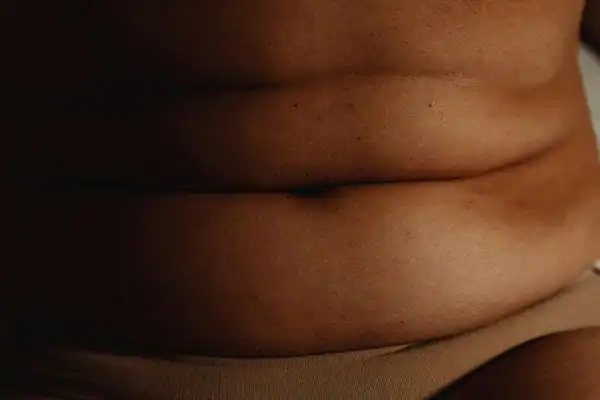 The Hidden Connection: How Stress Shapes Your Fitness and Body Composition 3 image of what stress can do on the stomach area and how Lipo 360 Leicester can help to change your body shape.